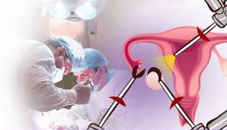 Menopausia quirúrgica o iatrogénica